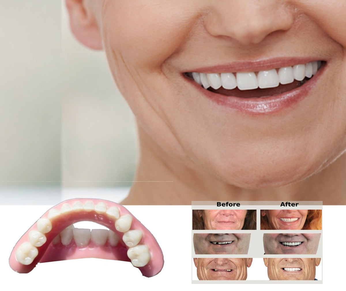 DIY Dentures Kit W197042